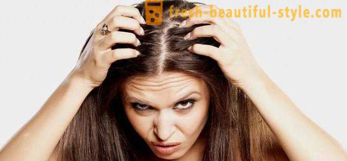 Zašto brz zhirneyut kosu? Mogući razlozi, značajke i metode liječenja