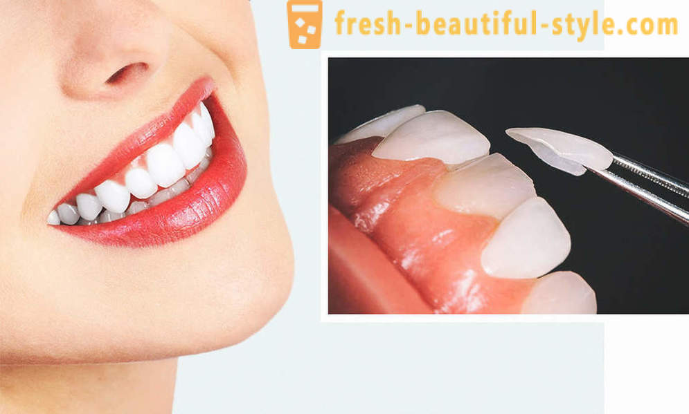 4, idealan način da zube
