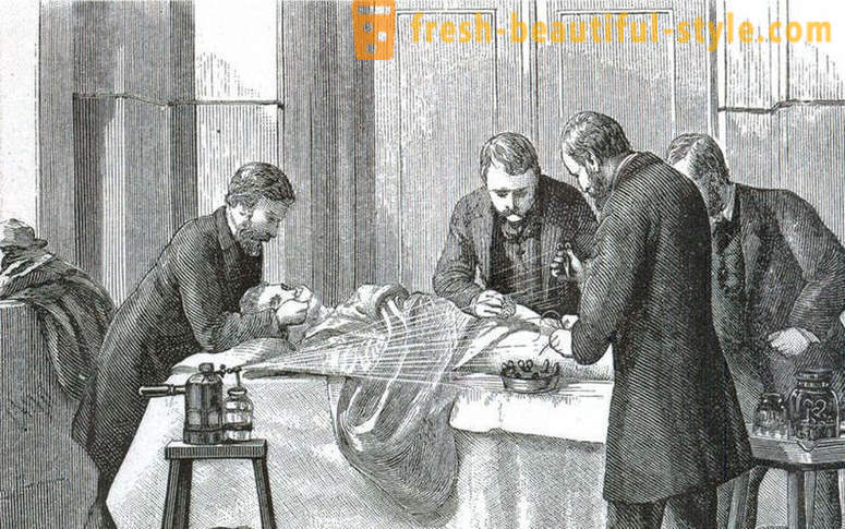 Šokantni činjenice o Victorian operacije