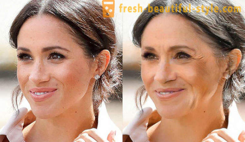 Liječnici su pokazali kako bi se prikazali Meghan Markle i Kate Middleton u starosti