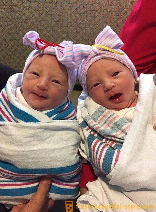 Nick Vuychich šarmantne blizanci rođeni