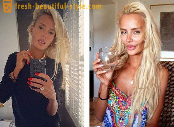 10 Ruski ljepotice prije i nakon plastične