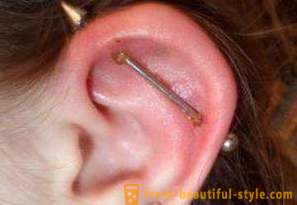 Punkcija hrskavice uha: liječenje, učinci
