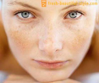 Zašto ljuskava koža na licu? Problem kože lica