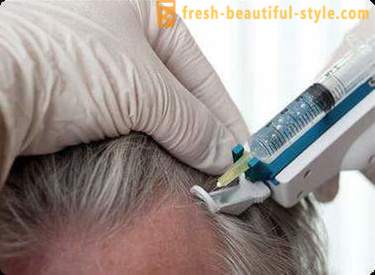 Mezoterapija za kosu: krema alata i kontraindikacije