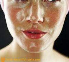 Masna koža lica: što učiniti da se bave problemom?