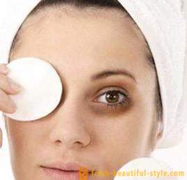 Savjeti o tome kako ukloniti tamne krugove ispod očiju